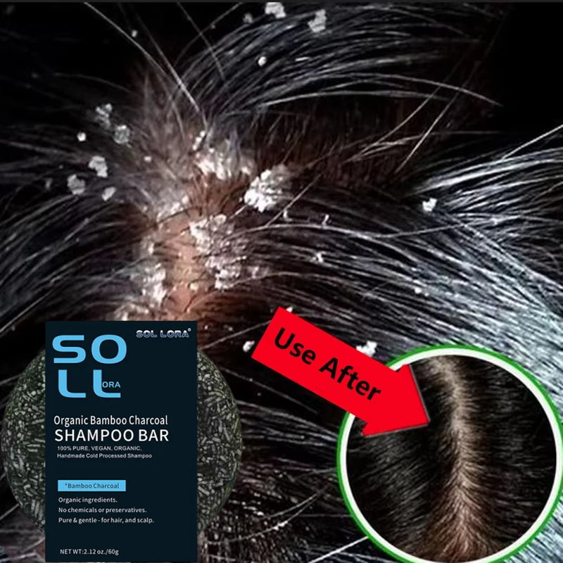 Fast Anti Dandruff Hair Treatm - огляд і ціна Hair Care Dandruff